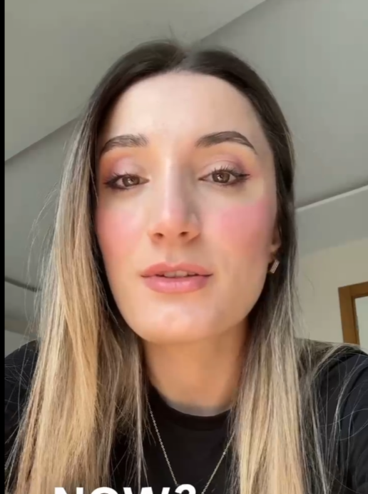 Alexis's Transformation